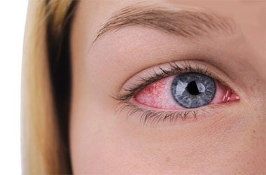 Emorragia oculare